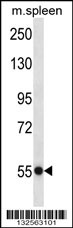 USP40 Antibody (N-term) (Cat. #AP13572a) western blot analysis in mouse spleen tissue lysates (35ug/lane).This demonstrates the USP40 antibody detected the USP40 protein (arrow).