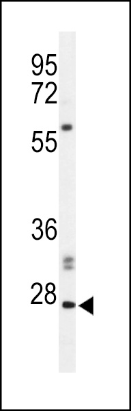 Western blot analysis of hPHO1-M1 (Cat. #AP1354a) in Jurkat cell line lysates (35ug/lane). PHO1 (arrow) was detected using the purified Pab.