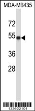 TUBA3C Antibody (C-term) (Cat. #AP13539b) western blot analysis in MDA-MB435 cell line lysates (35ug/lane).This demonstrates the TUBA3C antibody detected the TUBA3C protein (arrow).