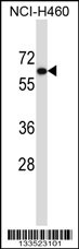 UGT2B11 Antibody (C-term) (Cat. #AP13518b) western blot analysis in NCI-H460 cell line lysates (35ug/lane).This demonstrates the UGT2B11 antibody detected the UGT2B11 protein (arrow).