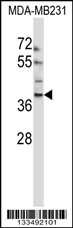 EMID1 Antibody (N-term) (Cat. #AP13509a) western blot analysis in MDA-MB231 cell line lysates (35ug/lane).This demonstrates the EMID1 antibody detected the EMID1 protein (arrow).