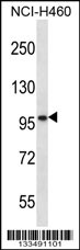 SLC6A17 Antibody (C-term) (Cat. #AP13508b) western blot analysis in NCI-H460 cell line lysates (35ug/lane).This demonstrates the SLC6A17 antibody detected the SLC6A17 protein (arrow).