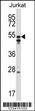 HNRNPH2 Antibody (C-term) (Cat. #AP13497b) western blot analysis in Jurkat cell line lysates (35ug/lane).This demonstrates the HNRNPH2 antibody detected the HNRNPH2 protein (arrow).