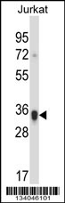 KIR2DS1 Antibody (Center) (Cat. #AP13902c) western blot analysis in Jurkat cell line lysates (35ug/lane).This demonstrates the KIR2DS1 antibody detected the KIR2DS1 protein (arrow).