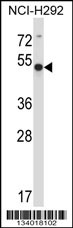 ACTR6 Antibody (C-term) (Cat. #AP13889b) western blot analysis in NCI-H292 cell line lysates (35ug/lane).This demonstrates the ACTR6 antibody detected the ACTR6 protein (arrow).