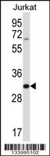 HRASLS5 Antibody (Center) (Cat. #AP13881c) western blot analysis in Jurkat cell line lysates (35ug/lane).This demonstrates the HRASLS5 antibody detected the HRASLS5 protein (arrow).