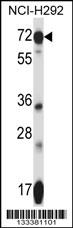 SLC41A2 Antibody (N-term) (Cat. #AP13832a) western blot analysis in NCI-H292 cell line lysates (35ug/lane).This demonstrates the SLC41A2 antibody detected the SLC41A2 protein (arrow).