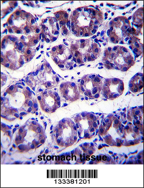SLC41A2 Antibody (N-term) (Cat. #AP13832a)immunohistochemistry analysis in formalin fixed and paraffin embedded human stomach tissue followed by peroxidase conjugation of the secondary antibody and DAB staining.This data demonstrates the use of SLC41A2 Antibody (N-term) for immunohistochemistry. Clinical relevance has not been evaluated.