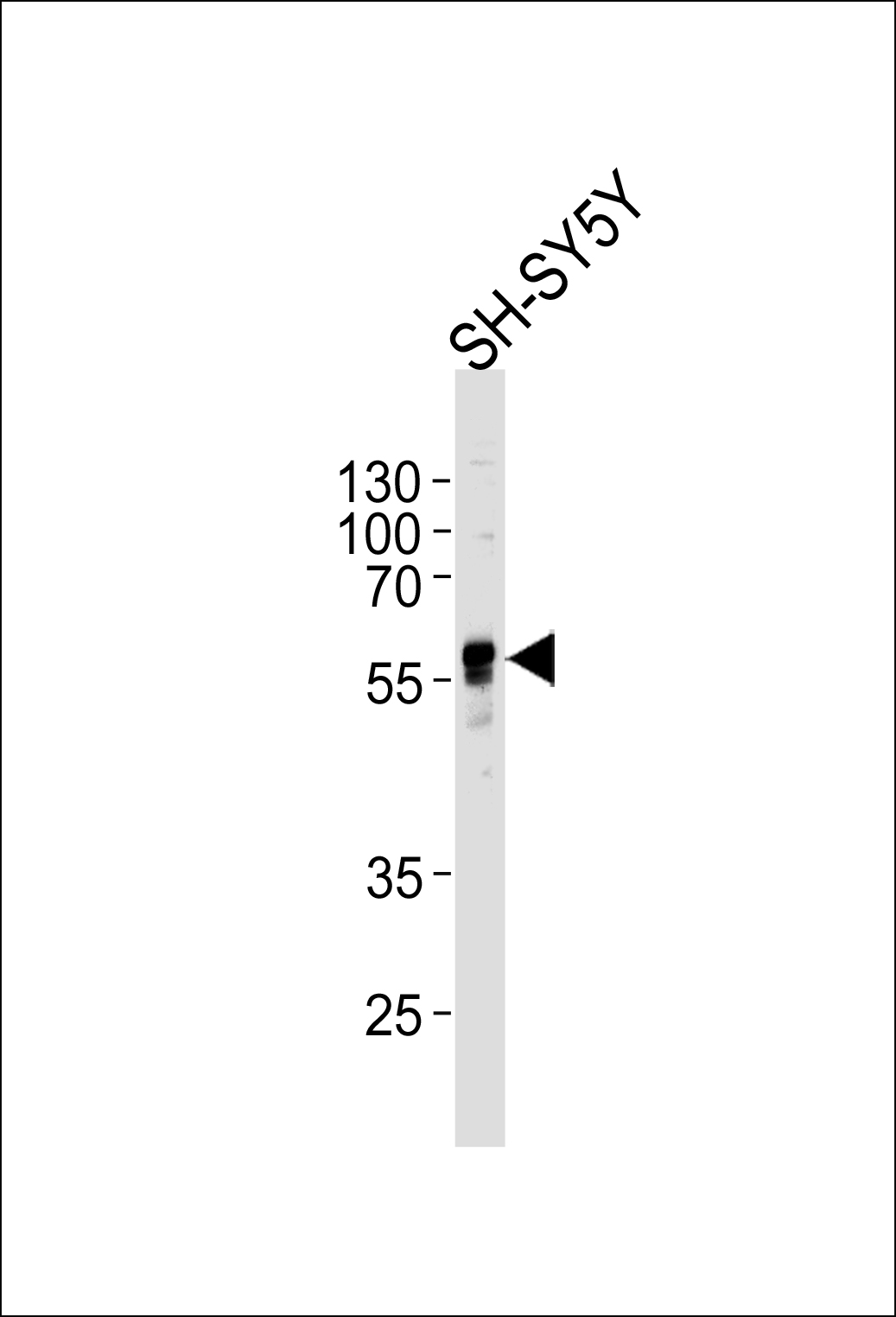 Western blot analysis of lysate from SH-SY5Y cell line, using ABHD3 Antibody (C-term)(Cat. #AP13830b). AP13830b was diluted at 1:1000 at each lane. A goat anti-rabbit IgG H&L(HRP) at 1:5000 dilution was used as the secondary antibody. Lysate at 35ug per lane.