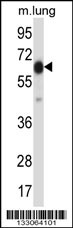 POF1B Antibody (Center) (Cat. #AP13828c) western blot analysis in mouse lung tissue lysates (35ug/lane).This demonstrates the POF1B antibody detected the POF1B protein (arrow).