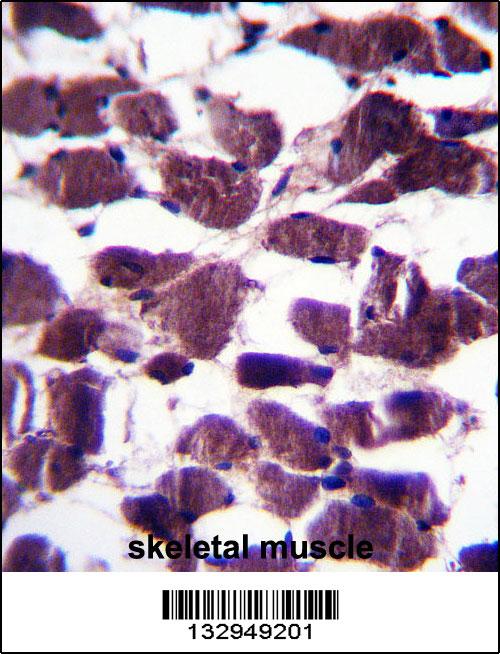 LRIG2 Antibody (C-term) (Cat. #AP13821b)immunohistochemistry analysis in formalin fixed and paraffin embedded human skeletal muscle followed by peroxidase conjugation of the secondary antibody and DAB staining.This data demonstrates the use of LRIG2 Antibody (C-term) for immunohistochemistry. Clinical relevance has not been evaluated.