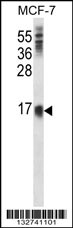 LY6E Antibody (Center) (Cat. #AP13818c) western blot analysis in MCF-7 cell line lysates (35ug/lane).This demonstrates the LY6E antibody detected the LY6E protein (arrow).