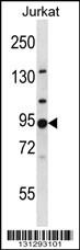 AP1G2 Antibody (N-term) (Cat. #AP13809a) western blot analysis in Jurkat cell line lysates (35ug/lane).This demonstrates the AP1G2 antibody detected the AP1G2 protein (arrow).