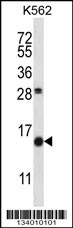 SCGB1D2 Antibody (Center) (Cat. #AP13793c) western blot analysis in K562 cell line lysates (35ug/lane).This demonstrates the SCGB1D2 antibody detected the SCGB1D2 protein (arrow).