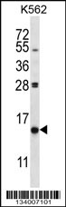 PIK3IP1 Antibody (C-term) (Cat. #AP13792b) western blot analysis in K562 cell line lysates (35ug/lane).This demonstrates the PIK3IP1 antibody detected the PIK3IP1 protein (arrow).