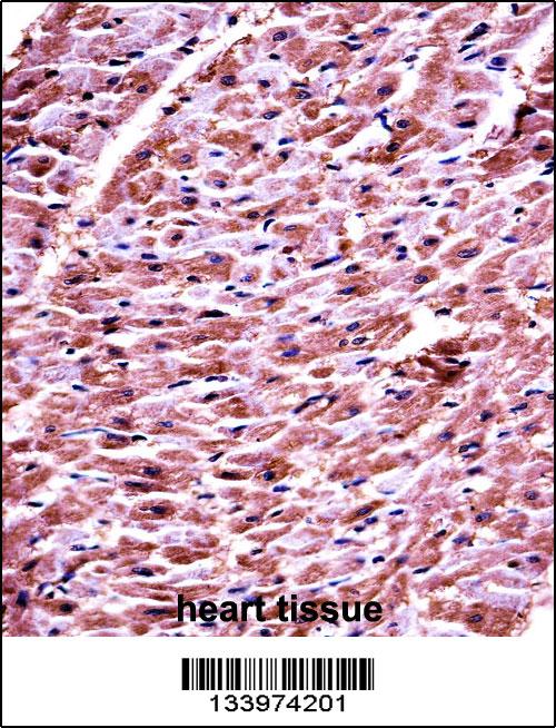 DHRS7C Antibody (Center) (AP13788c)immunohistochemistry analysis in formalin fixed and paraffin embedded human heart tissue followed by peroxidase conjugation of the secondary antibody and DAB staining.This data demonstrates the use of DHRS7C Antibody (Center) for immunohistochemistry. Clinical relevance has not been evaluated.