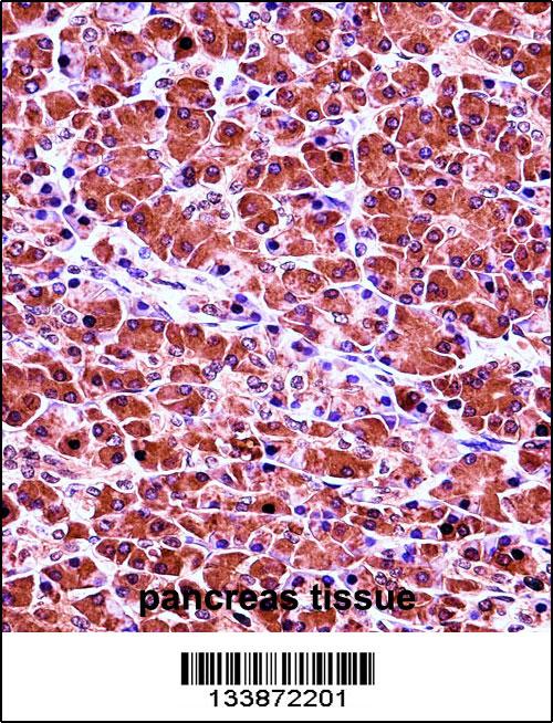 CELA3B Antibody (N-term) (Cat. #AP13770a)immunohistochemistry analysis in formalin fixed and paraffin embedded human pancreas tissue followed by peroxidase conjugation of the secondary antibody and DAB staining.This data demonstrates the use of CELA3B Antibody (N-term) for immunohistochemistry. Clinical relevance has not been evaluated.