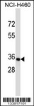 OR14C36 Antibody (C-term) (Cat. #AP13761b) western blot analysis in NCI-H460 cell line lysates (35ug/lane).This demonstrates the OR14C36 antibody detected the OR14C36 protein (arrow).