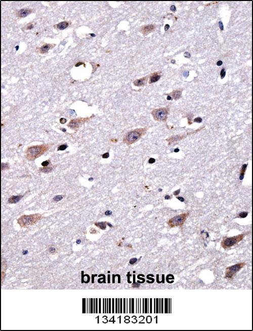 CREG2 Antibody (C-term) (AP14122b)immunohistochemistry analysis in formalin fixed and paraffin embedded human brain tissue followed by peroxidase conjugation of the secondary antibody and DAB staining.This data demonstrates the use of CREG2 Antibody (C-term) for immunohistochemistry. Clinical relevance has not been evaluated.