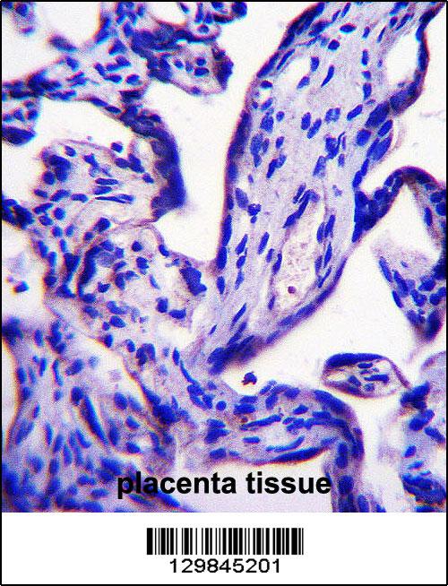 EFCB7 Antibody (C-term) (Cat. #AP14097b)immunohistochemistry analysis in formalin fixed and paraffin embedded human placenta tissue followed by peroxidase conjugation of the secondary antibody and DAB staining.This data demonstrates the use of EFCB7 Antibody (C-term) for immunohistochemistry. Clinical relevance has not been evaluated.