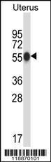 CPO Antibody (N-term) (Cat. #AP14095a) western blot analysis in human normal Uterus tissue lysates (35ug/lane).This demonstrates the CPO antibody detected the CPO protein (arrow).