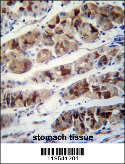 PCIA1 Antibody (Center) (Cat. #AP14094c)immunohistochemistry analysis in formalin fixed and paraffin embedded human stomach tissue followed by peroxidase conjugation of the secondary antibody and DAB staining.This data demonstrates the use of PCIA1 Antibody (Center) for immunohistochemistry. Clinical relevance has not been evaluated.