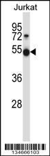 Mouse Pim1 Antibody (C-term) (Cat. #AP14077b) western blot analysis in Jurkat cell line lysates (35ug/lane).This demonstrates the Pim1 antibody detected the Pim1 protein (arrow).