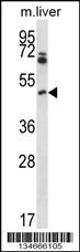 Mouse Pim1 Antibody (C-term) (Cat. #AP14077b) western blot analysis in mouse liver tissue lysates (35ug/lane).This demonstrates the Pim1 antibody detected the Pim1 protein (arrow).