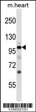Mouse Npr1 Antibody (N-term) (Cat. #AP14073a) western blot analysis in mouse heart tissue lysates (35ug/lane).This demonstrates the Npr1 antibody detected the Npr1 protein (arrow).