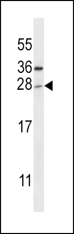 TICAM2 Antibody (N-term) (Cat. #AP14060a) western blot analysis in human placenta tissue lysates (35ug/lane).This demonstrates the TICAM2 antibody detected the TICAM2 protein (arrow).