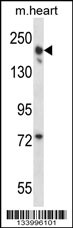 LRRC16B Antibody (C-term) (Cat. #AP14016b) western blot analysis in mouse heart tissue lysates (35ug/lane).This demonstrates the LRRC16B antibody detected the LRRC16B protein (arrow).