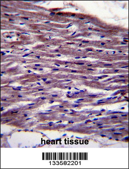 UNC45B Antibody (N-term) (Cat. #AP13982a)immunohistochemistry analysis in formalin fixed and paraffin embedded human heart tissue followed by peroxidase conjugation of the secondary antibody and DAB staining.This data demonstrates the use of UNC45B Antibody (N-term) for immunohistochemistry. Clinical relevance has not been evaluated.