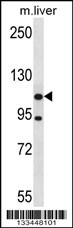 ADNP2 Antibody (Center) (Cat. #AP13981c) western blot analysis in mouse liver tissue lysates (35ug/lane).This demonstrates the ADNP2 antibody detected the ADNP2 protein (arrow).