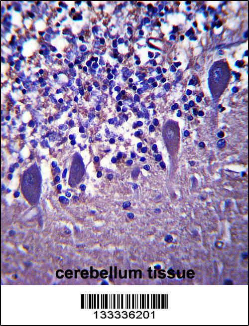 LRRC8B Antibody (N-term ) (Cat. #AP13978a)immunohistochemistry analysis in formalin fixed and paraffin embedded human cerebellum tissue followed by peroxidase conjugation of the secondary antibody and DAB staining.This data demonstrates the use of LRRC8B Antibody (N-term ) for immunohistochemistry. Clinical relevance has not been evaluated.
