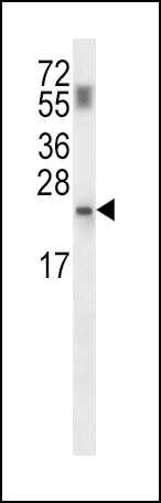 PPCDC Antibody (N-term) (Cat. #AP13975a) western blot analysis in mouse kidney tissue lysates (35ug/lane).This demonstrates the PPCDC antibody detected the PPCDC protein (arrow).