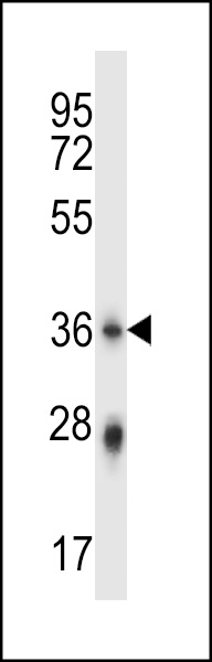PLSCR4 Antibody (Center) (Cat. #AP13974c) western blot analysis in mouse stomach tissue lysates (35ug/lane).This demonstrates the PLSCR4 antibody detected the PLSCR4 protein (arrow).