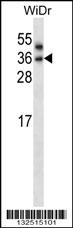 PNPLA4 Antibody (C-term) (Cat. #AP13971b) western blot analysis in WiDr cell line lysates (35ug/lane).This demonstrates the PNPLA4 antibody detected the PNPLA4 protein (arrow).