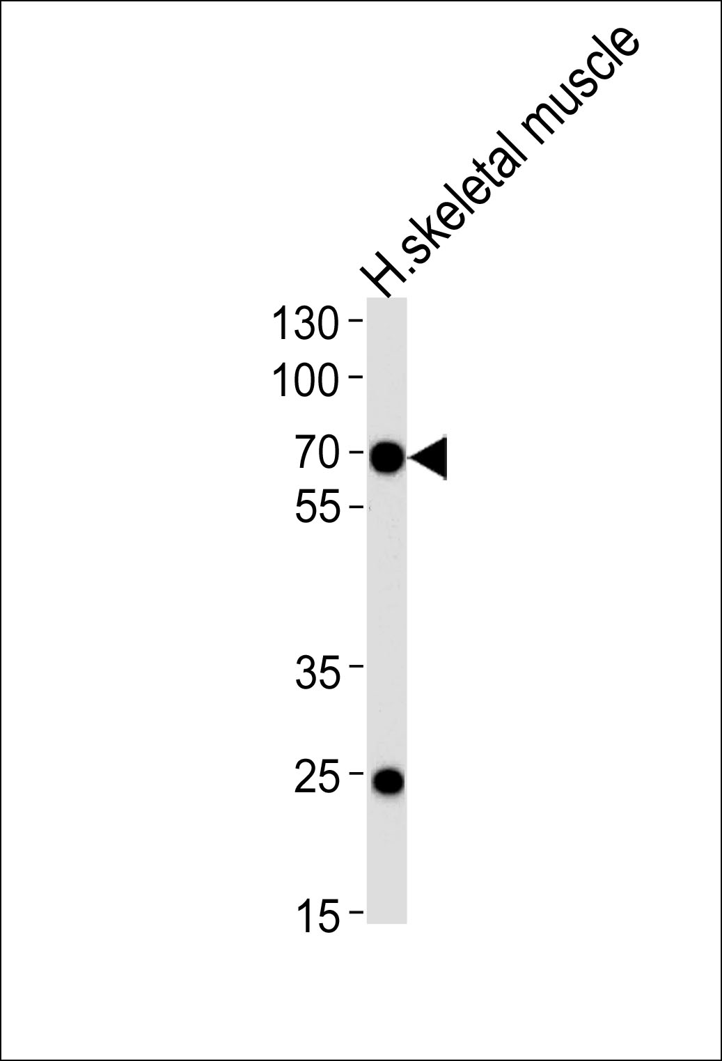 Western blot analysis of lysate from human skeletal muscle tissue lysate, using C4orf18 Antibody (Center)(Cat. #AP13966c). AP13966c was diluted at 1:1000 at each lane. A goat anti-rabbit IgG H&L(HRP) at 1:5000 dilution was used as the secondary antibody. Lysate at 35ug per lane.