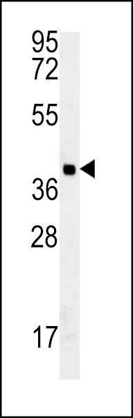 GDPD3 Antibody (N-term) (Cat. #AP13964a) western blot analysis in MDA-MB435 cell line lysates (35ug/lane).This demonstrates the GDPD3 antibody detected the GDPD3 protein (arrow).
