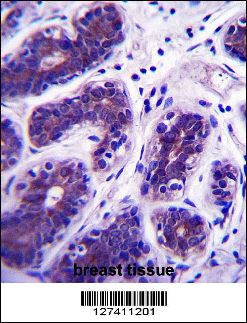 GDPD3 Antibody (N-term) (Cat. #AP13964a)immunohistochemistry analysis in formalin fixed and paraffin embedded human breast tissue followed by peroxidase conjugation of the secondary antibody and DAB staining.This data demonstrates the use of GDPD3 Antibody (N-term) for immunohistochemistry. Clinical relevance has not been evaluated.