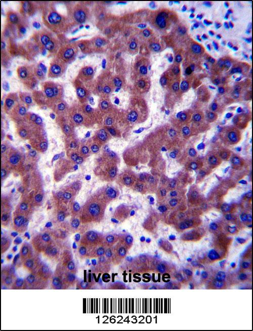 ERG25 Antibody (C-term) (Cat. #AP13954b)immunohistochemistry analysis in formalin fixed and paraffin embedded human liver tisssue followed by peroxidase conjugation of the secondary antibody and DAB staining.This data demonstrates the use of ERG25 Antibody (C-term) for immunohistochemistry. Clinical relevance has not been evaluated.