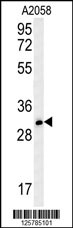 TRI73 Antibody (C-term) (Cat. #AP13953b) western blot analysis in A2058 cell line lysates (35ug/lane).This demonstrates the TRI73 antibody detected the TRI73 protein (arrow).