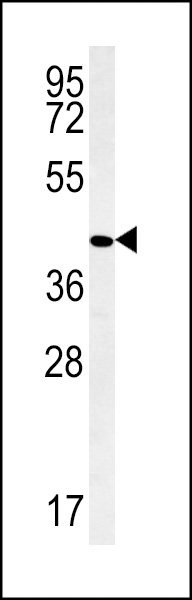 PPAN Antibody (C-term) (Cat. #AP13950b) western blot analysis in ZR-75-1 cell line lysates (35ug/lane).This demonstrates the PPAN antibody detected the PPAN protein (arrow).