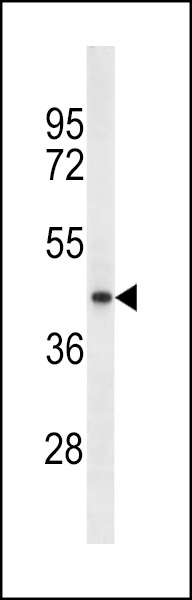 SRD5A2L2 Antibody (C-term)(Ascites)(Cat. #AM2127a) western blot analysis in A549 cell line lysates (35ug/lane).This demonstrates the SRD5A2L2 antibody detected the SRD5A2L2 protein (arrow).