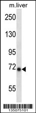 Mouse Ikbke Antibody (Center) (Cat. #AP14288c) western blot analysis in mouse liver tissue lysates (35ug/lane).This demonstrates the Ikbke antibody detected the Ikbke protein (arrow).