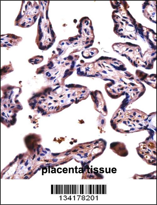 D19L4 Antibody (N-term) (AP14213a)immunohistochemistry analysis in formalin fixed and paraffin embedded human placenta tissue followed by peroxidase conjugation of the secondary antibody and DAB staining.This data demonstrates the use of D19L4 Antibody (N-term) for immunohistochemistry. Clinical relevance has not been evaluated.