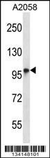 TMC6 Antibody (N-term) (Cat. #AP14212a) western blot analysis in A2058 cell line lysates (35ug/lane).This demonstrates the TMC6 antibody detected the TMC6 protein (arrow).