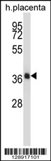 NKX2-4 Antibody (N-term) (Cat. #AP14182a) western blot analysis in human placenta tissue lysates (35ug/lane).This demonstrates the NKX2-4 antibody detected the NKX2-4 protein (arrow).