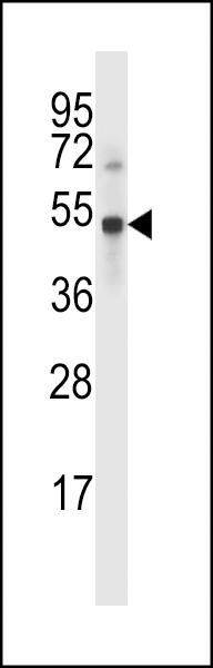UBP46 Antibody (C-term) (Cat. #AP14161b) western blot analysis in MDA-MB231 cell line lysates (35ug/lane).This demonstrates the UBP46 antibody detected the UBP46 protein (arrow).