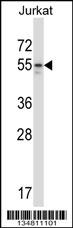 Mouse Map2k7 Antibody (Center) (Cat. #AP14155c) western blot analysis in Jurkat cell line lysates (35ug/lane).This demonstrates the Map2k7 antibody detected the Map2k7 protein (arrow).